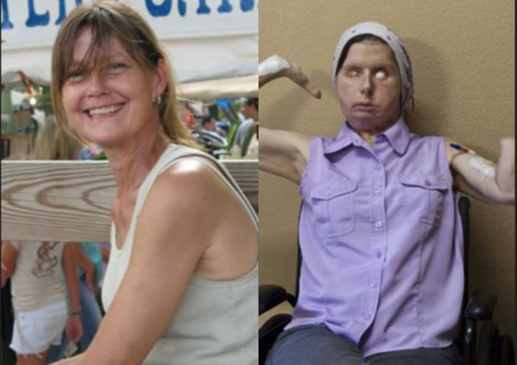 Charla Nash: Lady Who Lost Her Face While Trying To Help Calm Friend’s Pet